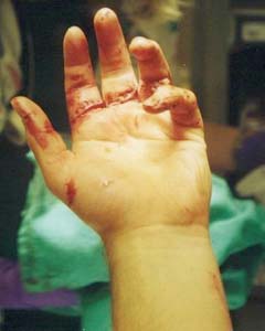 Shattering the Myth of Wired Glass